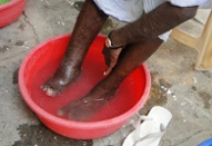 Sponsor an ulcer care for a leprosy patient